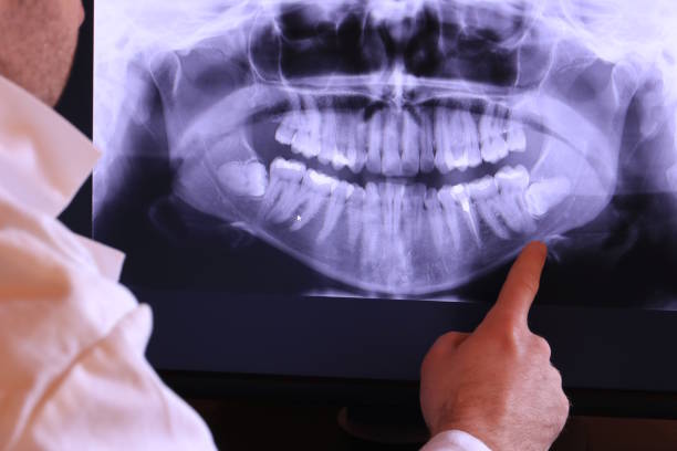 Best Emergency Treatment for Jaw Pain or Injury in Salem, UT