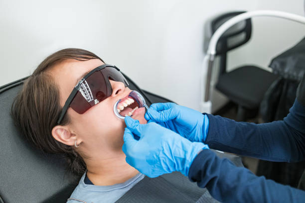Best Emergency Wisdom Tooth Extraction in Salem, UT